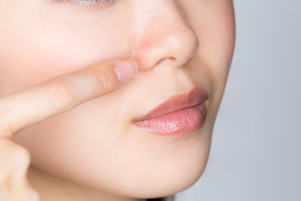 小鼻の角栓はどうしてできる 3つの毛穴タイプとセルフ 美容皮膚科での8つの改善方法を徹底解説 Novus Beauty Clinic ノバスビューティークリニック